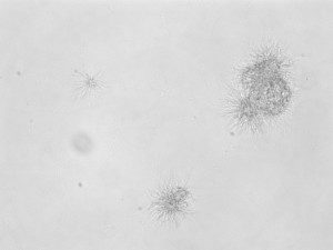 Image: Borrelia burgdorferi bacteria clustered in a lab dish. Because the growth media for Borrelia is not readily available, Dr. Rob Moritz’s lab at ISB had to formulate the components “from scratch.”